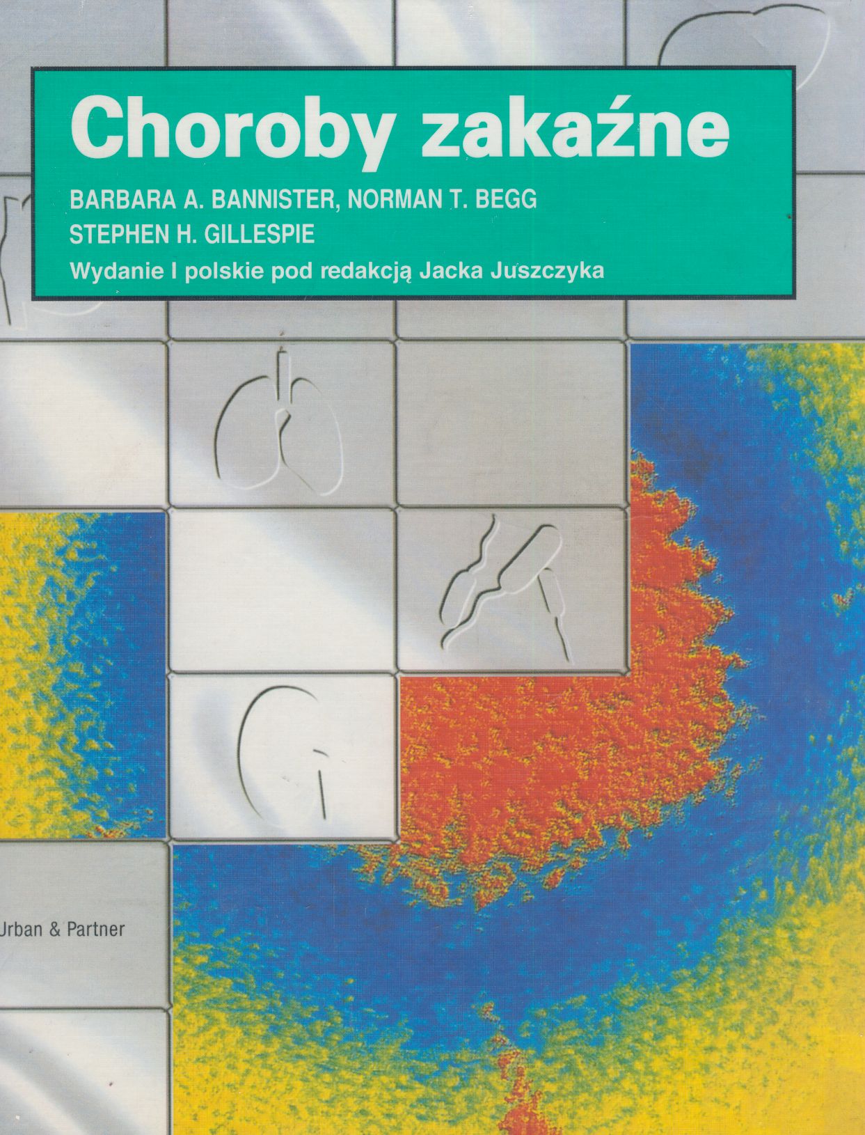 Choroby zakaźne